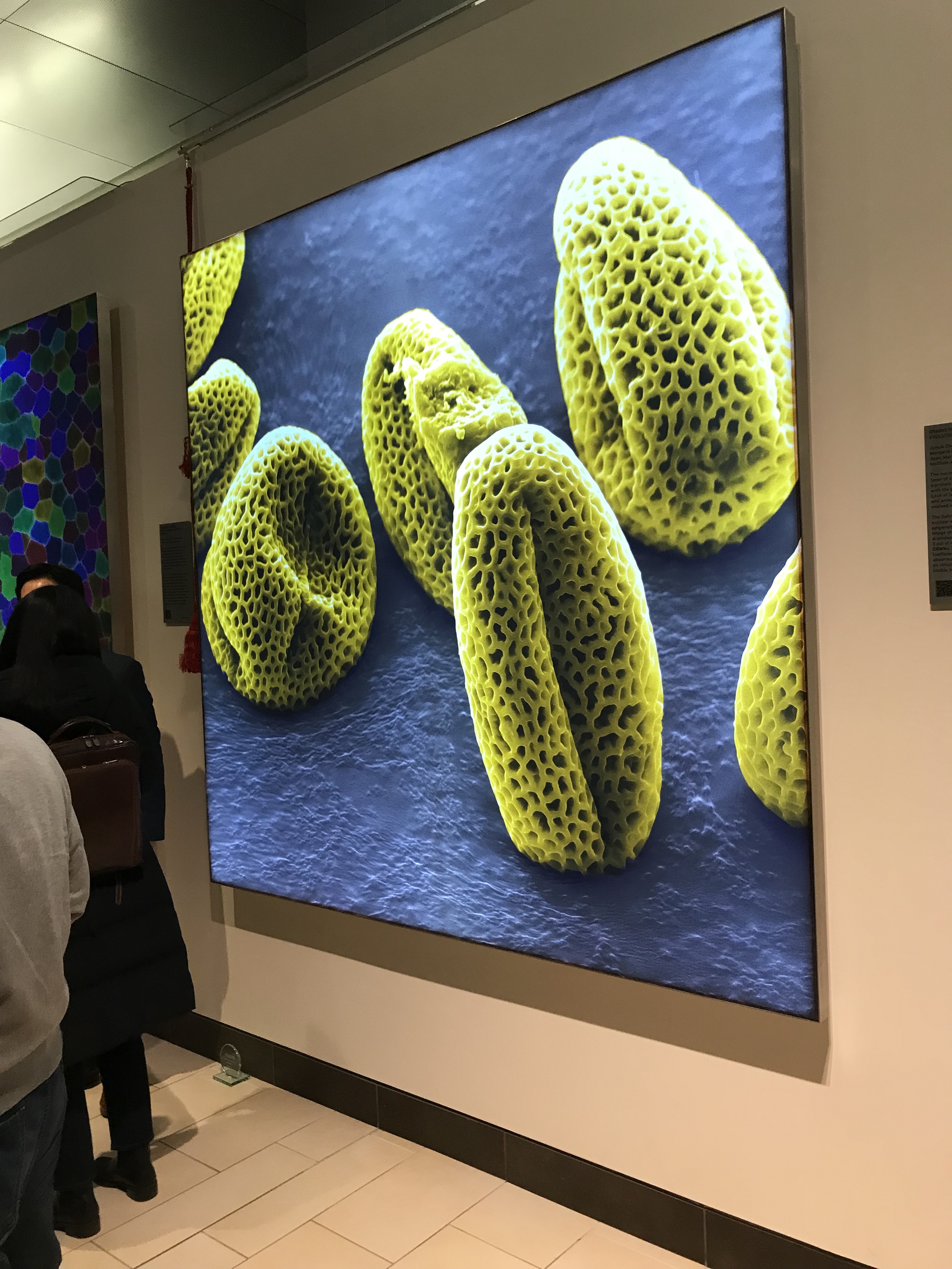 Framed photo hanging on a wall of Microscopic view of yellow mishapen pollen lacking proteins on gray background